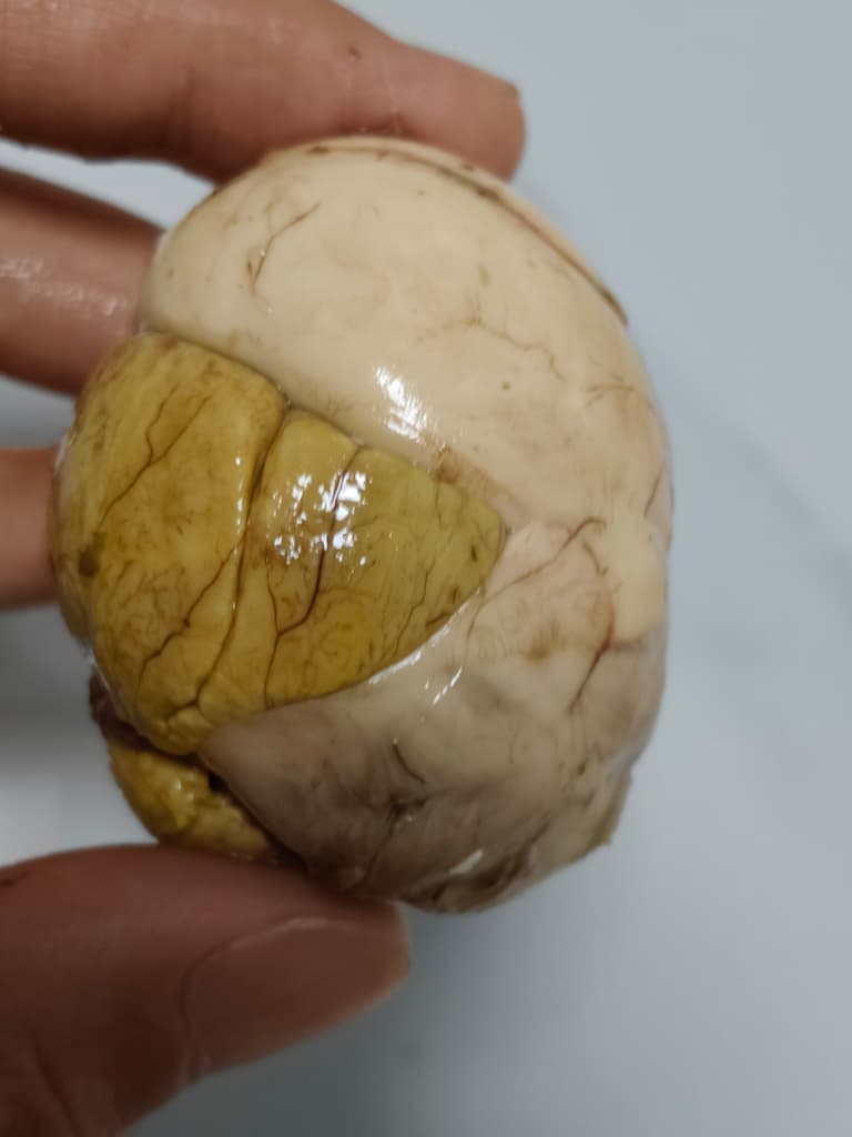 活珠子